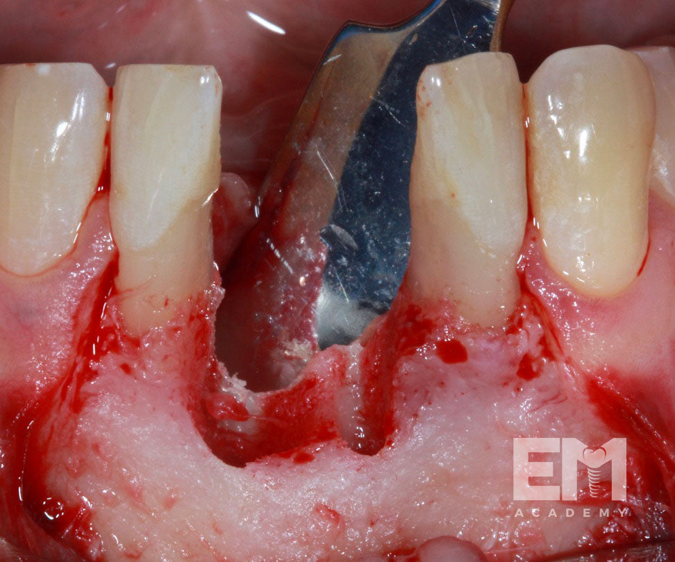 Total Tissue Training