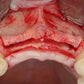 Predictable Implantology 2: Working with Biology