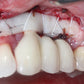 Predictable Implantology 2: Working with Biology
