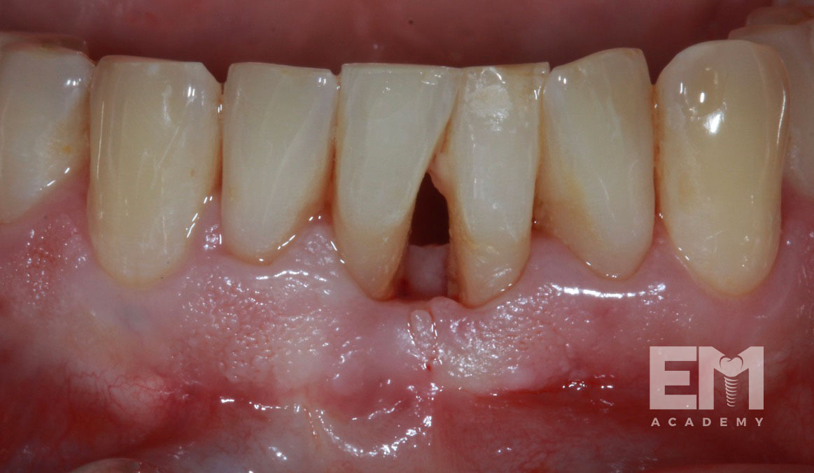 Total Tissue Training