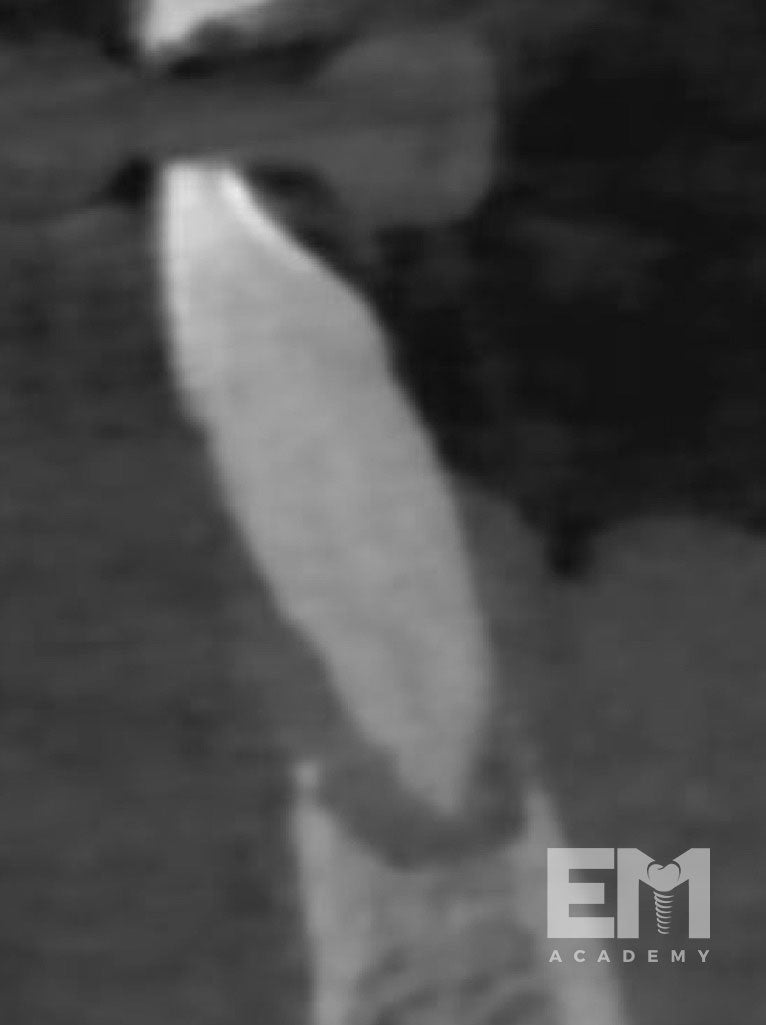 Total Tissue Training