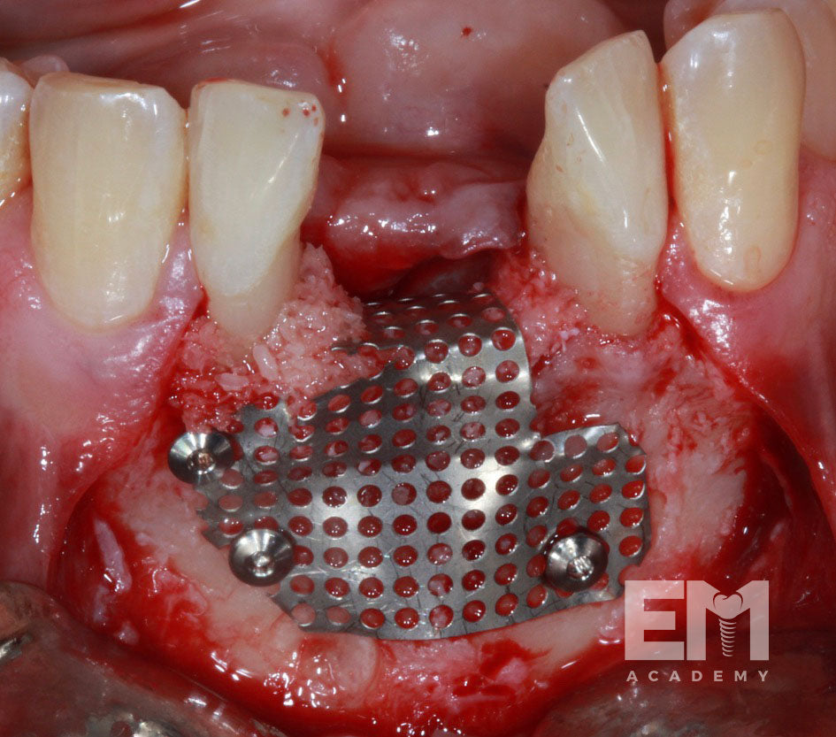 Total Tissue Training