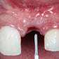 Predictable Implantology 2: Working with Biology