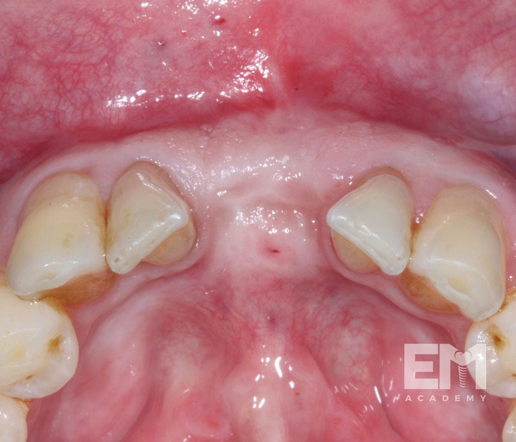 Total Tissue Training