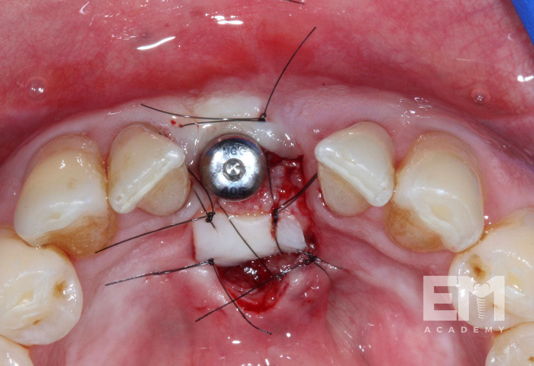 Total Tissue Training