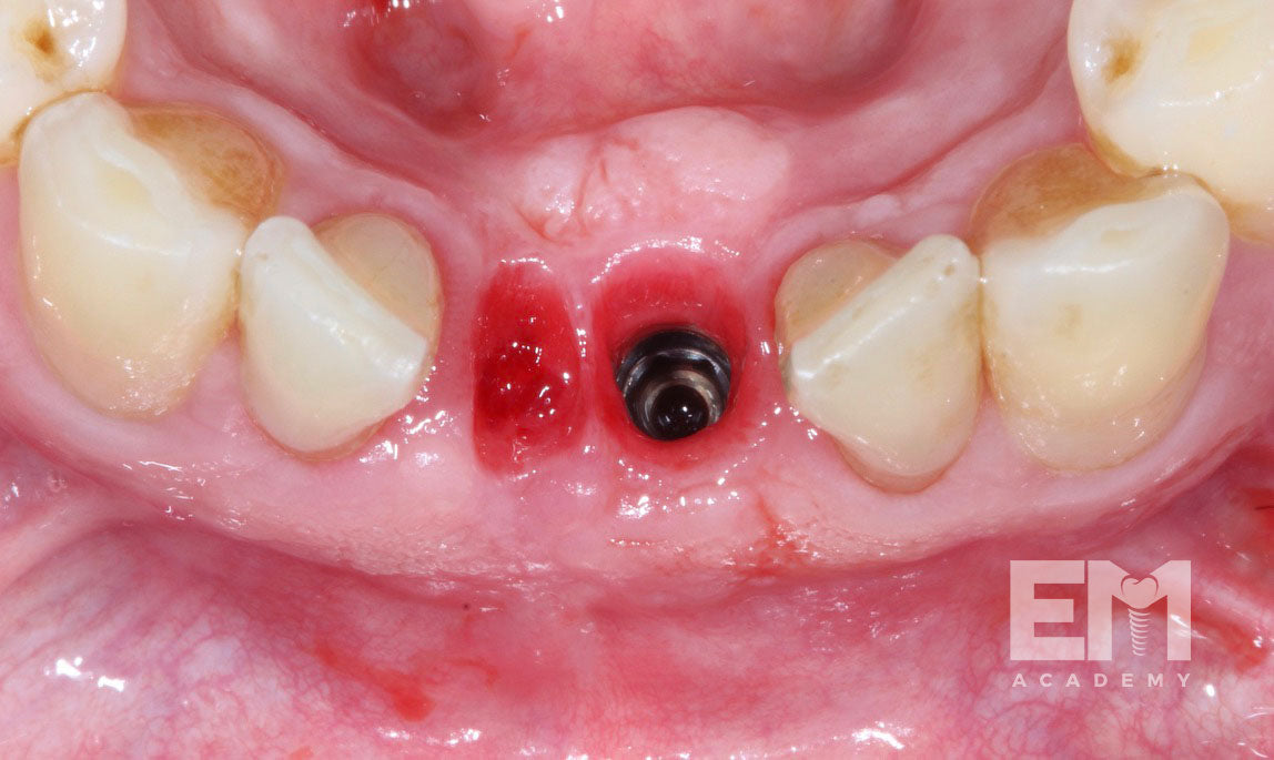 Total Tissue Training