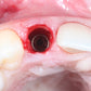 Predictable Implantology 2: Working with Biology