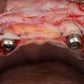 Predictable Implantology 2: Working with Biology