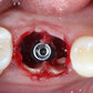 Predictable Implantology 2: Working with Biology