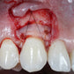 Soft Tissue Management for Teeth and Implants - The Complete Course in New York